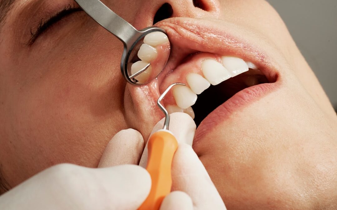 Dental Care Costs in Retirement: What to Know